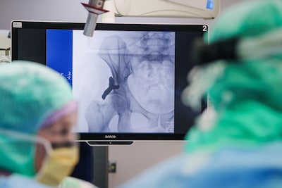 Wereldprimeur in Geldrop: na hond krijgt nu ook de eerste mens een ‘kapje’ op de heup