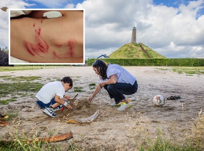 Wolf sleept jongetje (6) aan oksel mee, zijn vader vertelt: ‘Hij vroeg zich af of de wolf dit ook aan zijn kindjes leert’