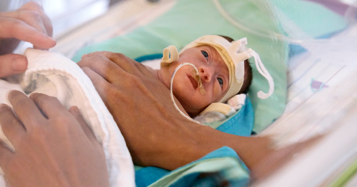 Speciale afdeling MMC Veldhoven is 'de best mogelijke plek' voor minimensje Raya