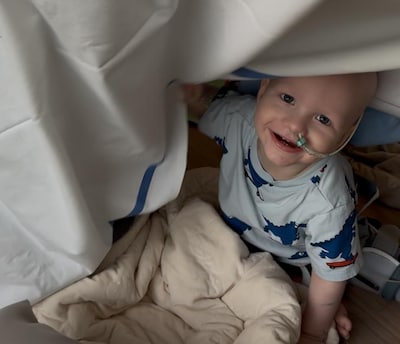 Hij kon net lopen, maar Hunter (1) moet nu verder leven met een geamputeerd linkerbeentje