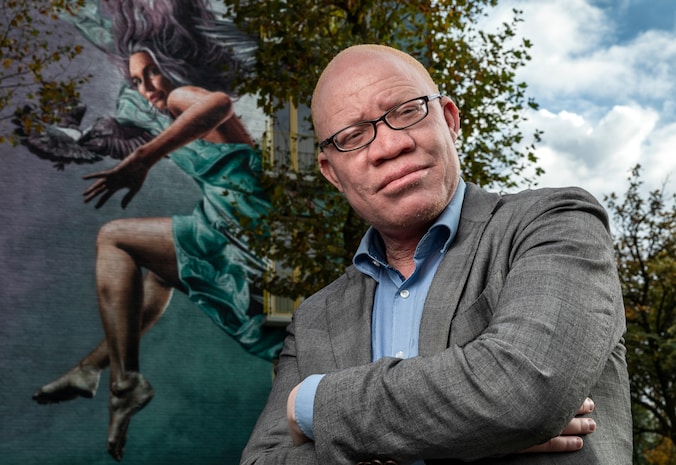 Albino Josephat Torner: 'Ik heb de dood geroken, maar ben niet bang ...