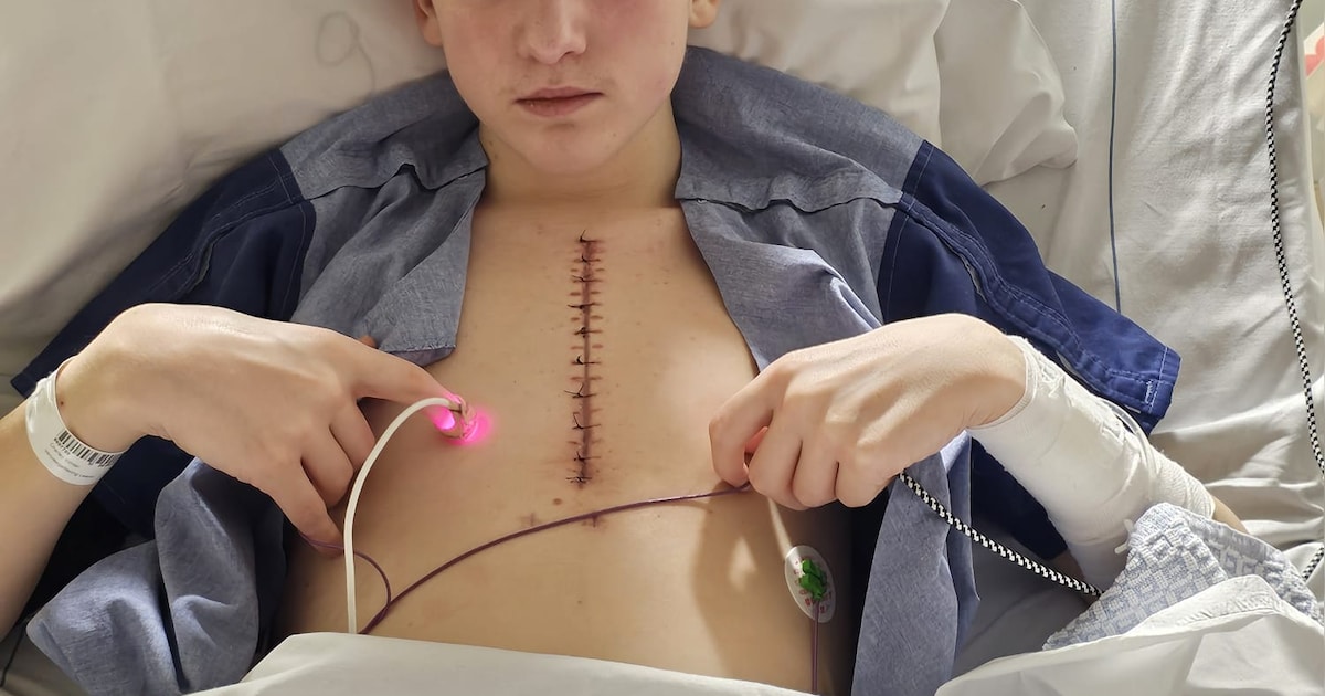 Charley (16) uit Lierop onderging operatie van 11 uur na verwoeste hartkleppen: ‘Artsen wisten het o